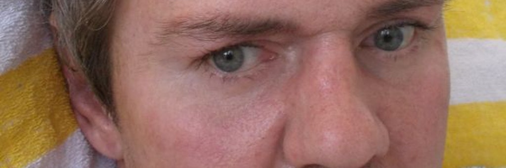 Da der Mann seit Monaten im Koma liegt und nicht vermisst wird, sucht die Berliner Polizei jetzt mit Bildern nach ihm.