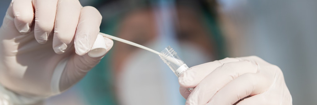 Die in Großbritannien aufgetretene Variante des Coronavirus wurde jetzt auch in Dresden entdeckt.