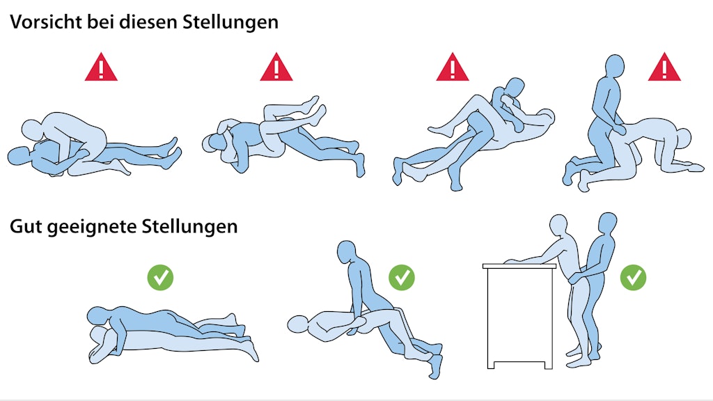 Die Grafik zeigt, welche Sex-Stellungen nach der Hüft-OP problemlos möglich sind und auf welche man eher verzichten sollte.