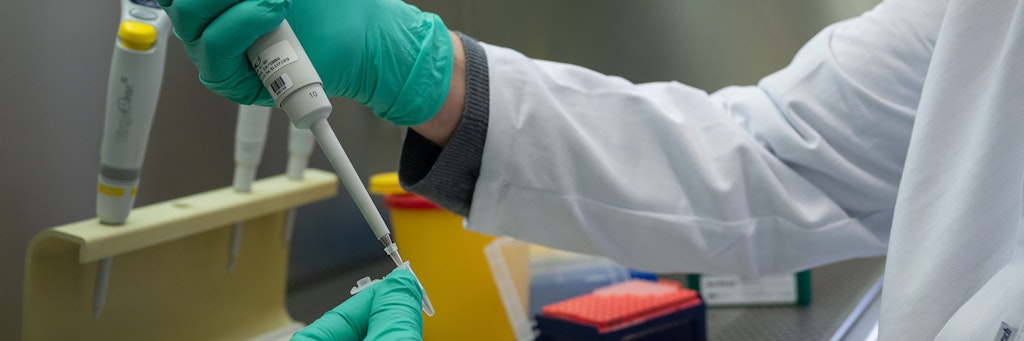 PCR-Test für die Analyse auf Mutationen des Coronavirus. (Symbolbild)