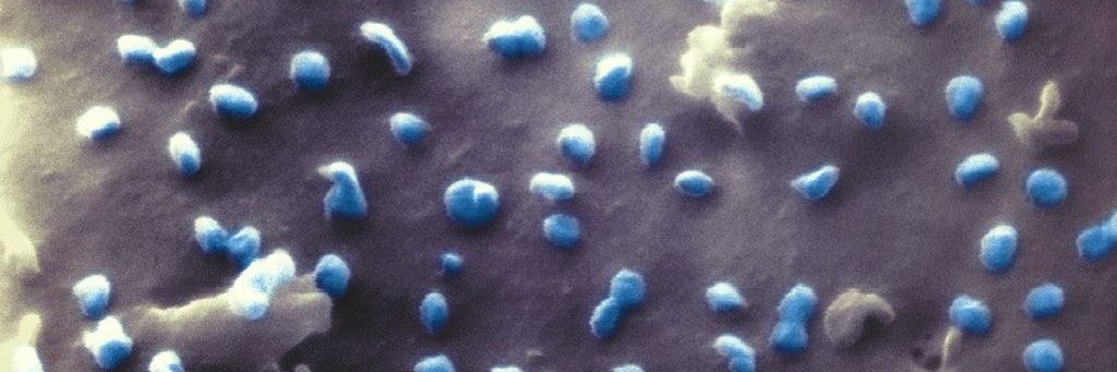 Coronaviren (blau) beim Austritt aus einer Nierenzelle, aufgenommen mit einem Heliumionen-Mikroskop.