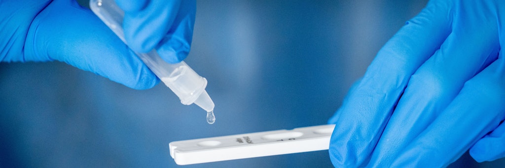 Medizinisches Personal führt einen Schnelltest durch. Jetzt kommen Produkte für den Laien.