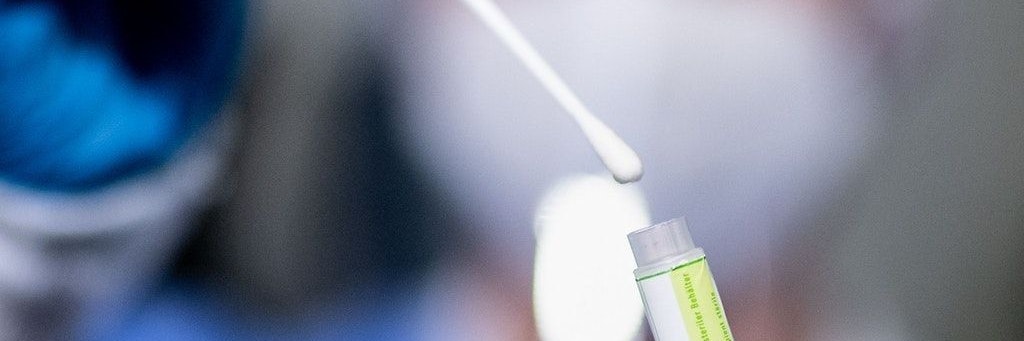 469 Neuinfektionen wurden in den letzten 24 Stunden gemeldet