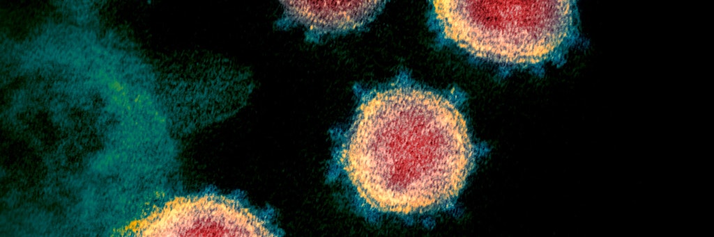Diese elektronenmikroskopische Aufnahme zeigt das Virus, das Covid-19 verursacht. 