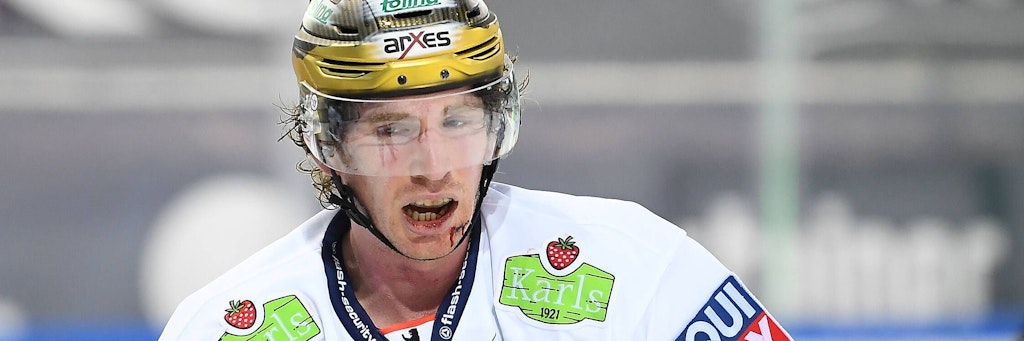 Tun schon beim Hinsehen weh: John Ramage wurde in Straubing während des Spiels im Gesicht genäht. 