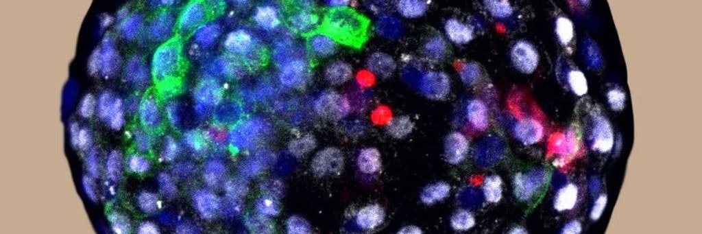 Diesem Affen-Embryo im Frühstadium – Blastozyste genannt – haben Forscher menschliche Stammzellen injiziert. Diese wurden farblich markiert.