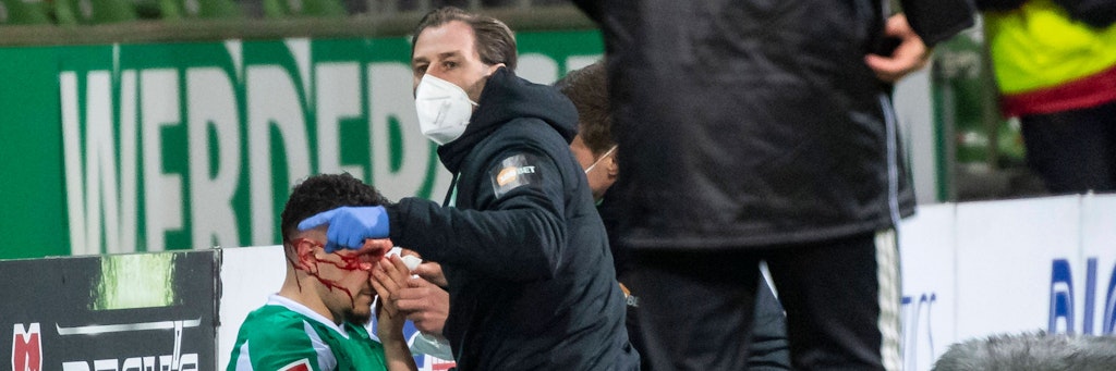 Werders Milos Veljkovic (l.) zog sich gegen Mainz einen Nasenbeinbruch zu und fällt gegen den 1. FC Union aus. 