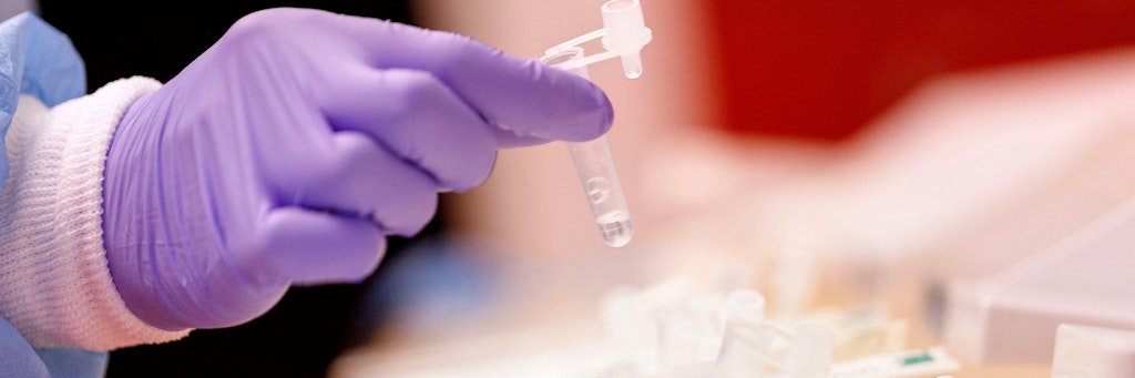 Mit dem Bürgertest haben alle Einwohner Deutschlands die Möglichkeit, sich kostenlos auf eine Infektion mit dem Corona-Virus testen zu lassen. 