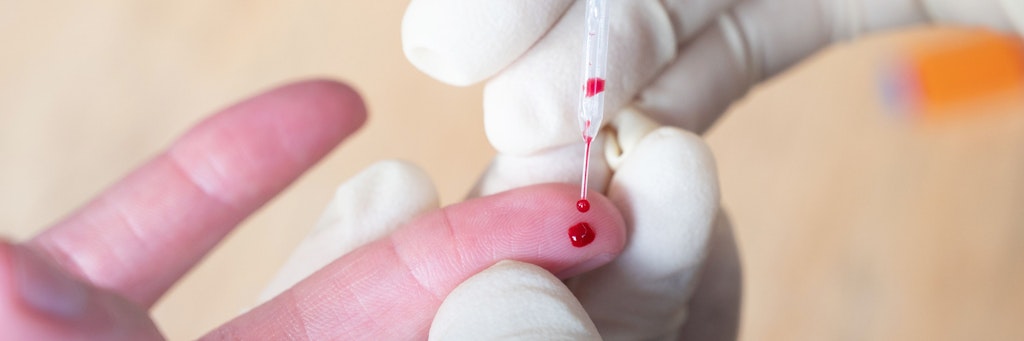 Für einen Corona-Antikörpertest muss Blut abgenommen werden. 