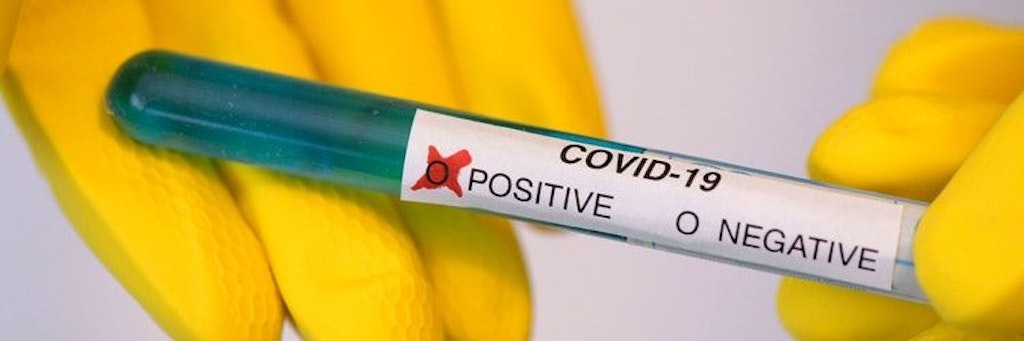 Bei rund 13.000 Geimpften fielen Corona-Tests positiv aus.