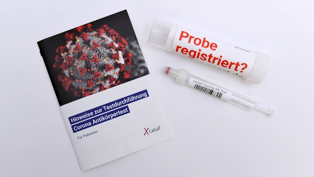 Das Tübinger Biotechnologieunternehmen CeGaT entwickelte einen Corona-Antikörpertest to go.
