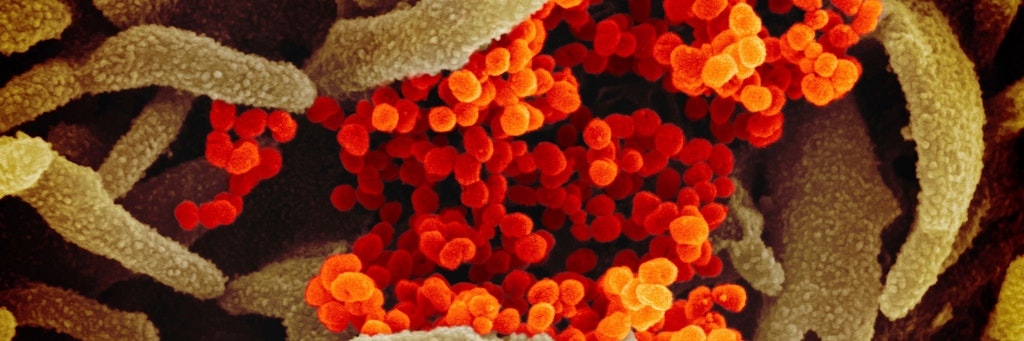 Coronavirus unter einem speziellen Mikroskop.