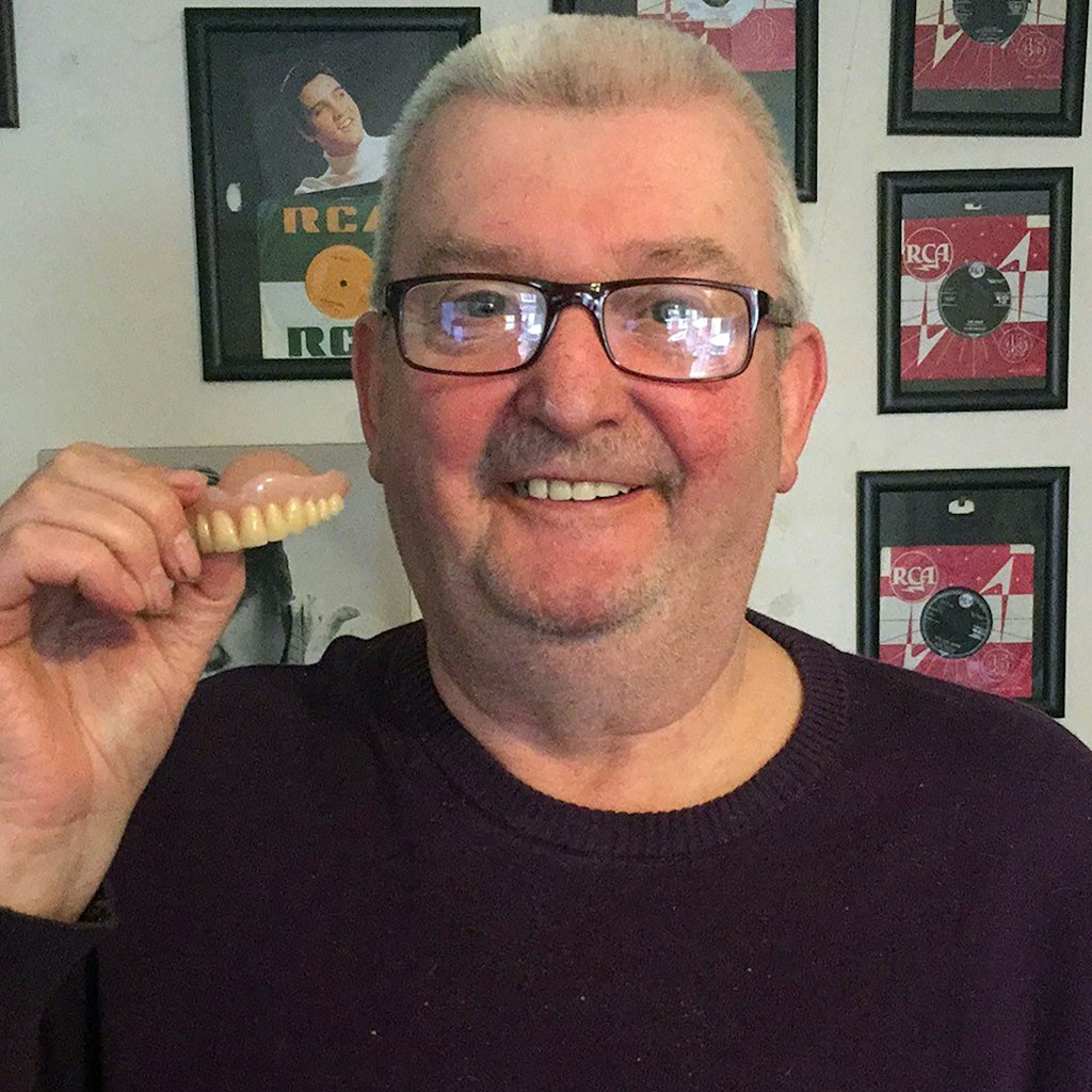 Paul Bishop zeigt seine dritten Zähne. Er hatte sie vor elf Jahren in Spanien verloren, nun kamen sie auf abenteuerliche Weise zu ihm zurück.