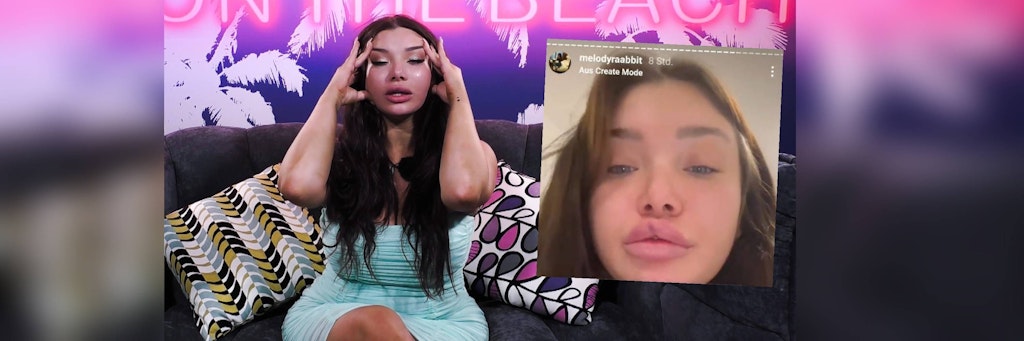 Ex-DSDS-Star Melody Haase kann es nicht fassen. Nach der Beauty-Behandlung kann sie ihren Mund nicht mehr schließen.