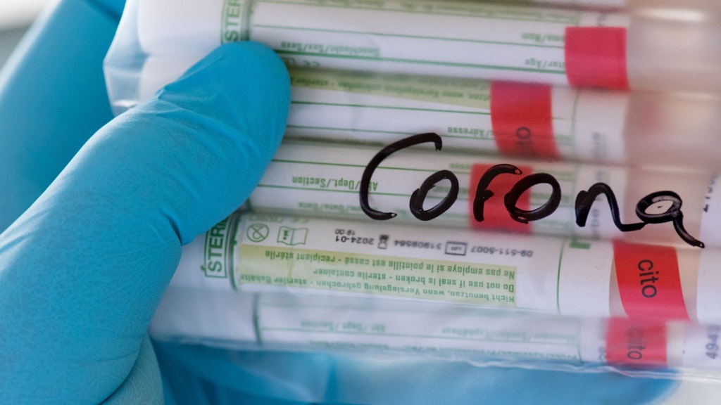 Proben für Corona-Tests werden für die weitere Untersuchung vorbereitet.