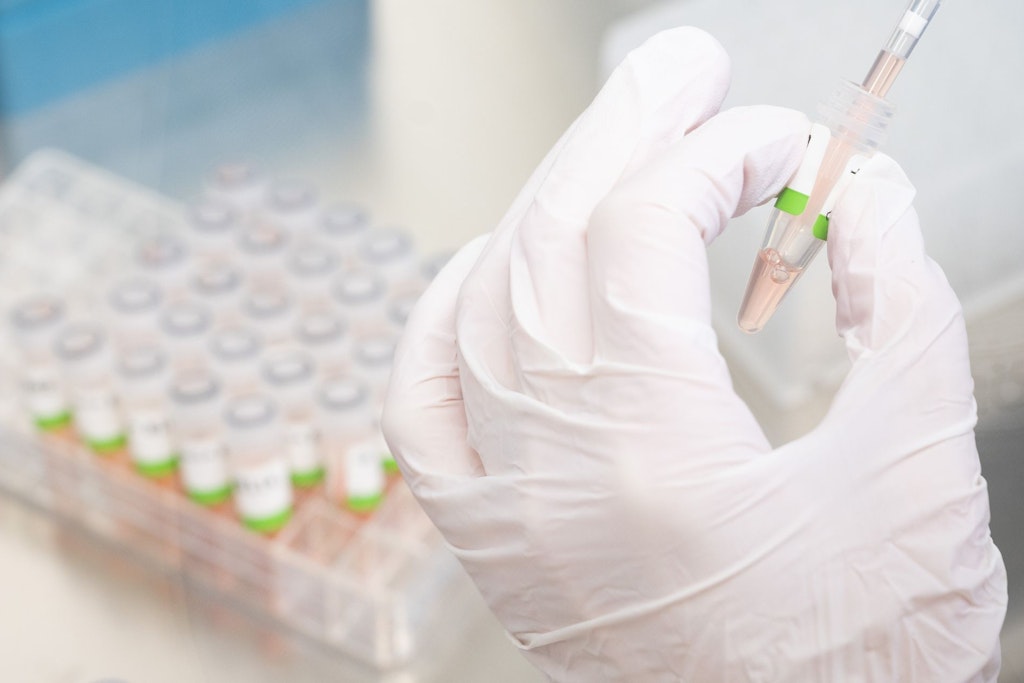 Eine biologisch-technische Assistentin bereitet PCR-Tests auf das Coronavirus von Patienten im PCR-Labor vor.
