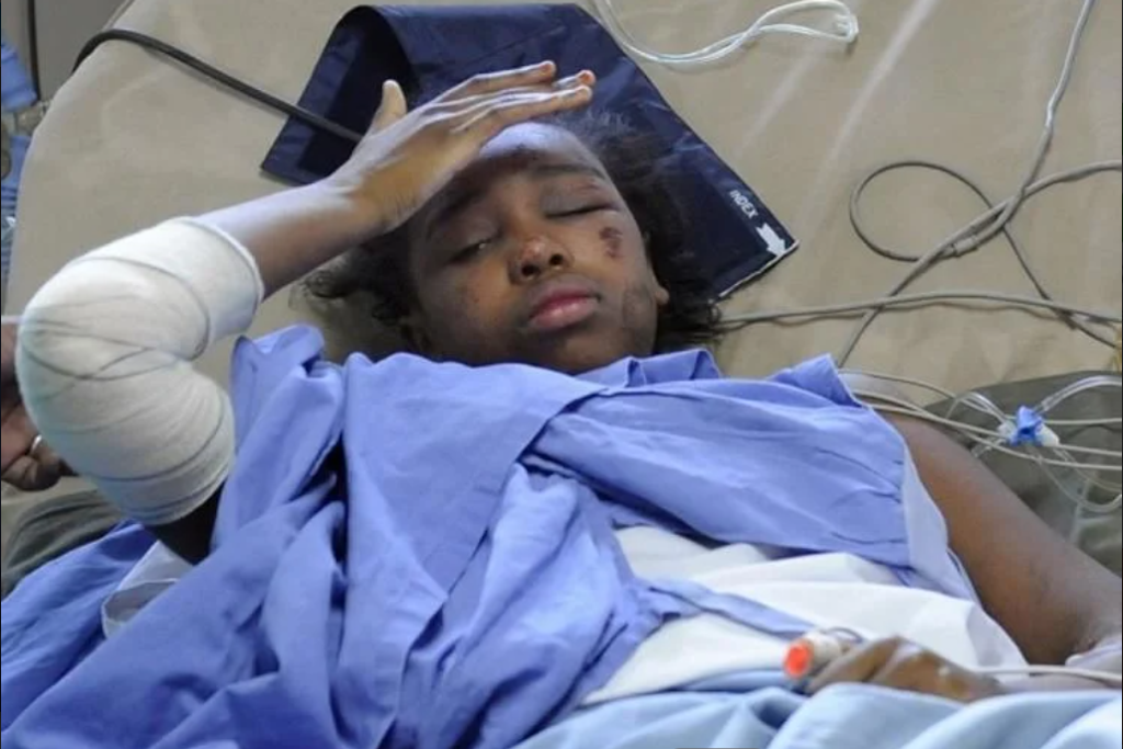 Die damals zwölfjährige Bahia kirz nach dem Absturz im Krankenhaus.