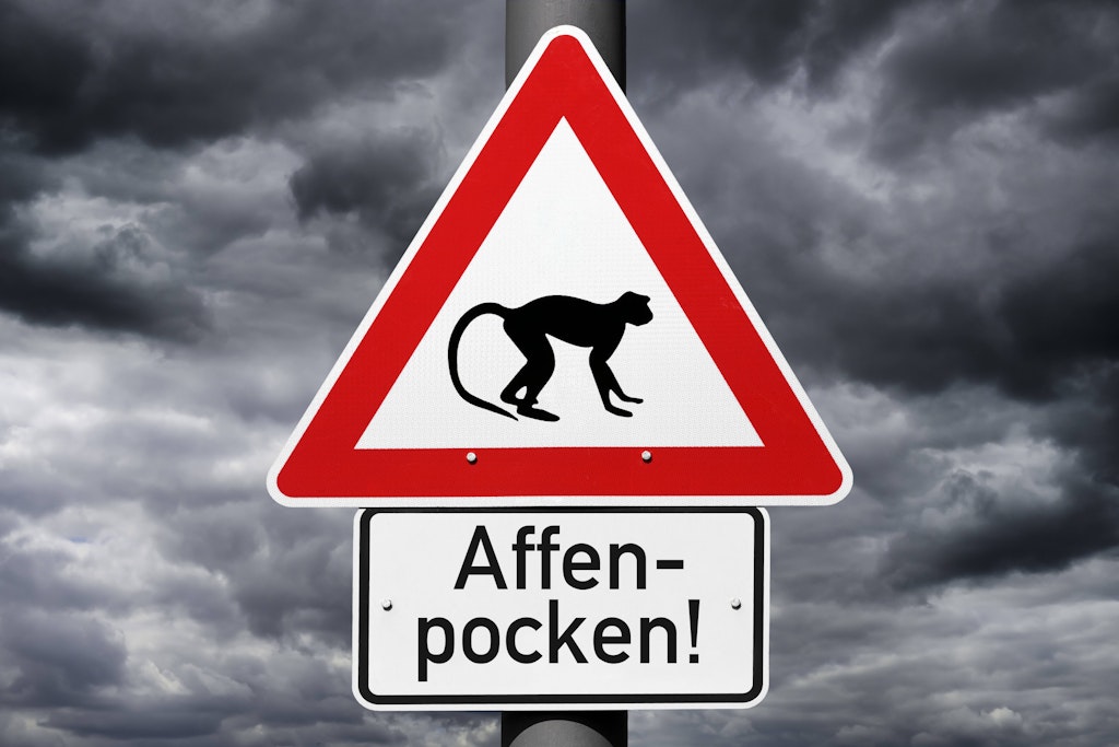 Die Affenpocken breiten sich gerade in Deutschland aus.