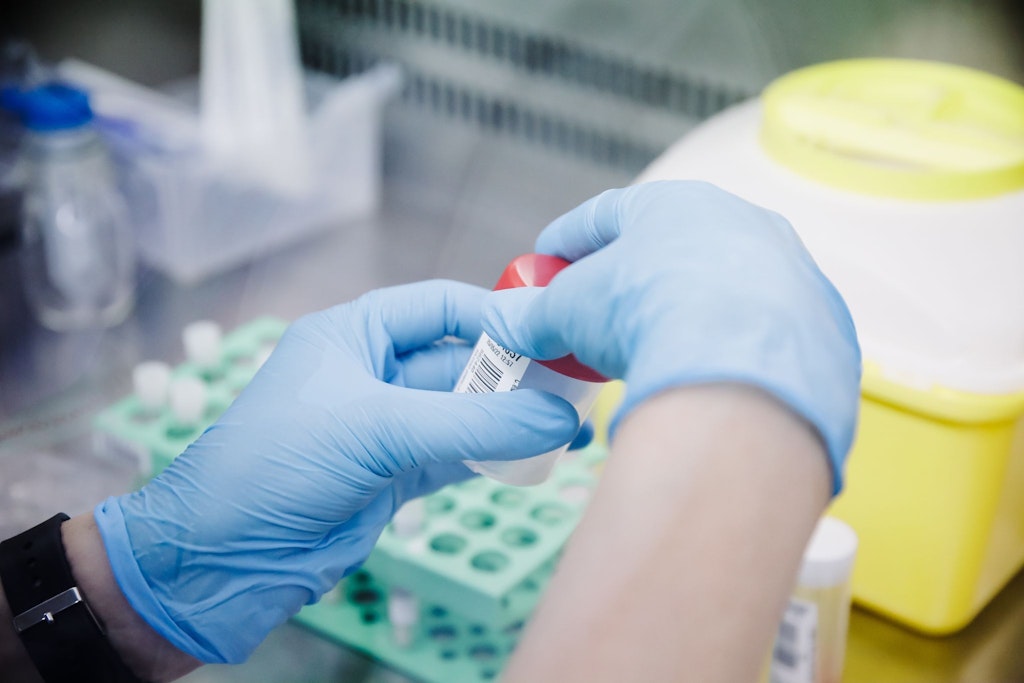 PCR-Test zur Erkennung des Affenpocken-Virus (Symbolbild)