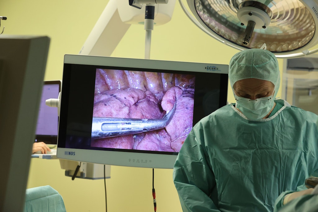 Endoskopische Lungen-Operationen wie diese in Gera werden sicher nicht ambulant durchgeführt werden, andere Eingriffe schon.