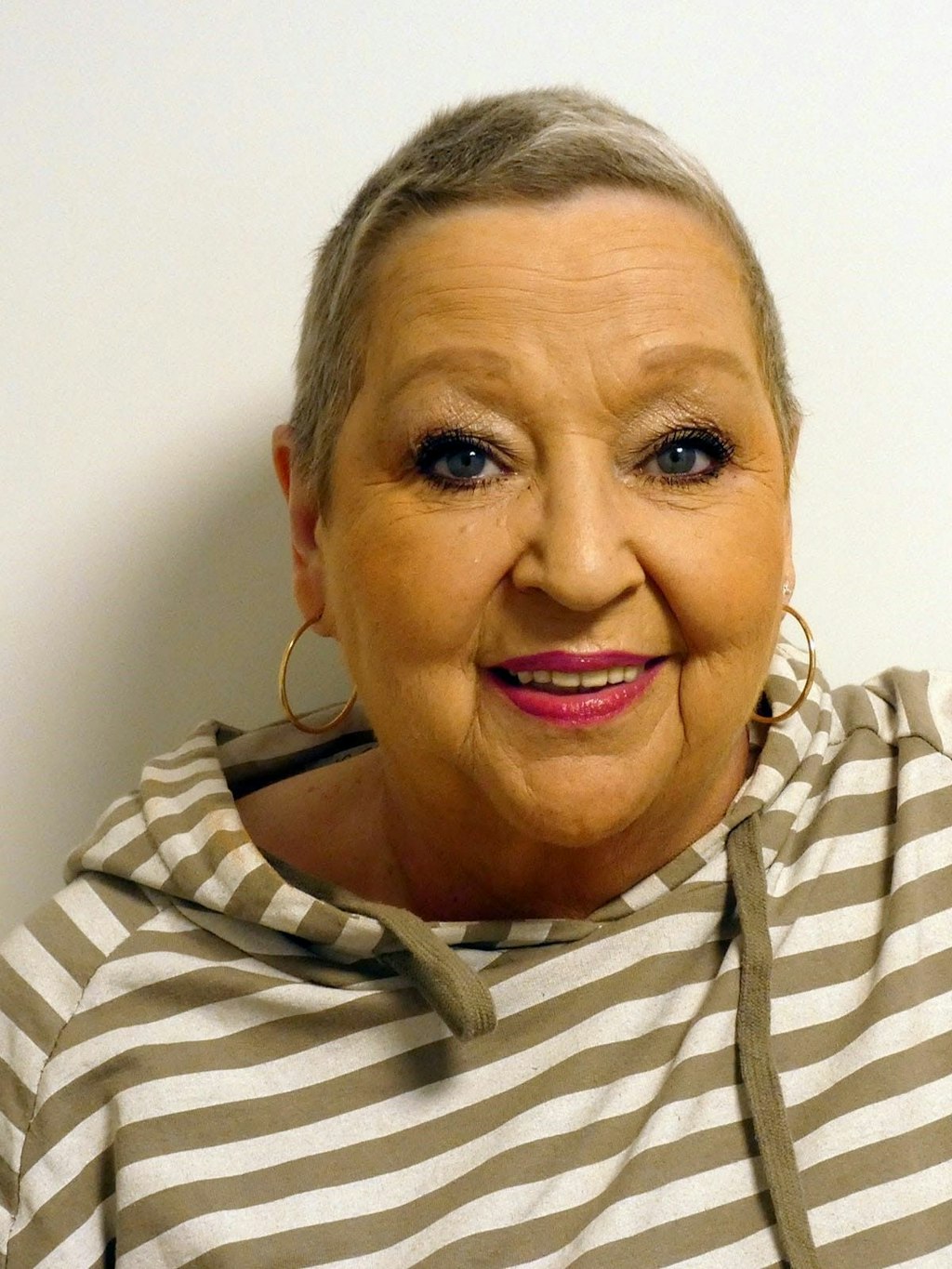 Angelika Mann: Durch die Chemo hatte sie anfangs eine Glatze. „Später wuchsen die Haare zu einer tollen Kurzhaarfrisur.“