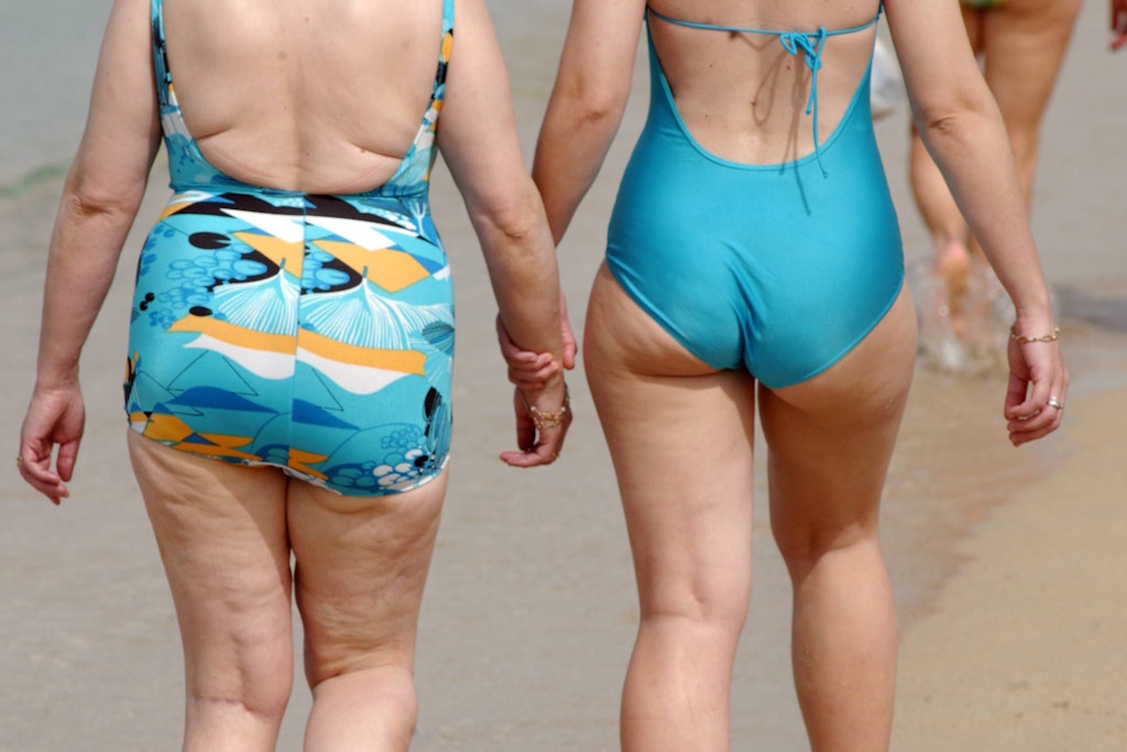 Was hilft gegen Cellulite? Es gibt verschiedene Mittel, sie alle helfen bestenfalls kurzfristig.
