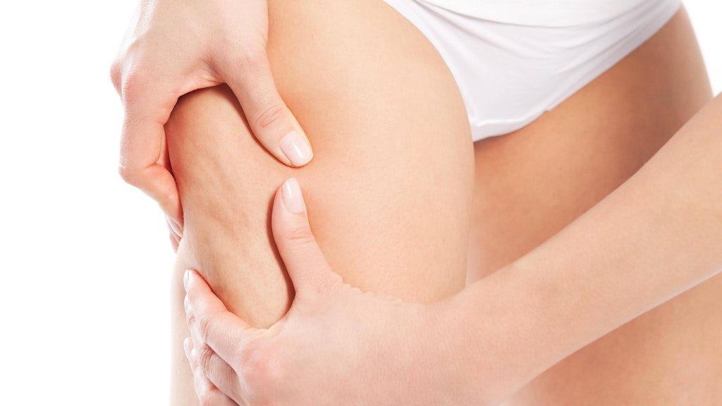 Cellulite kommt nicht nur bei dicken Menschen vor. Auch dünne Frauen können unter Cellulite leiden.