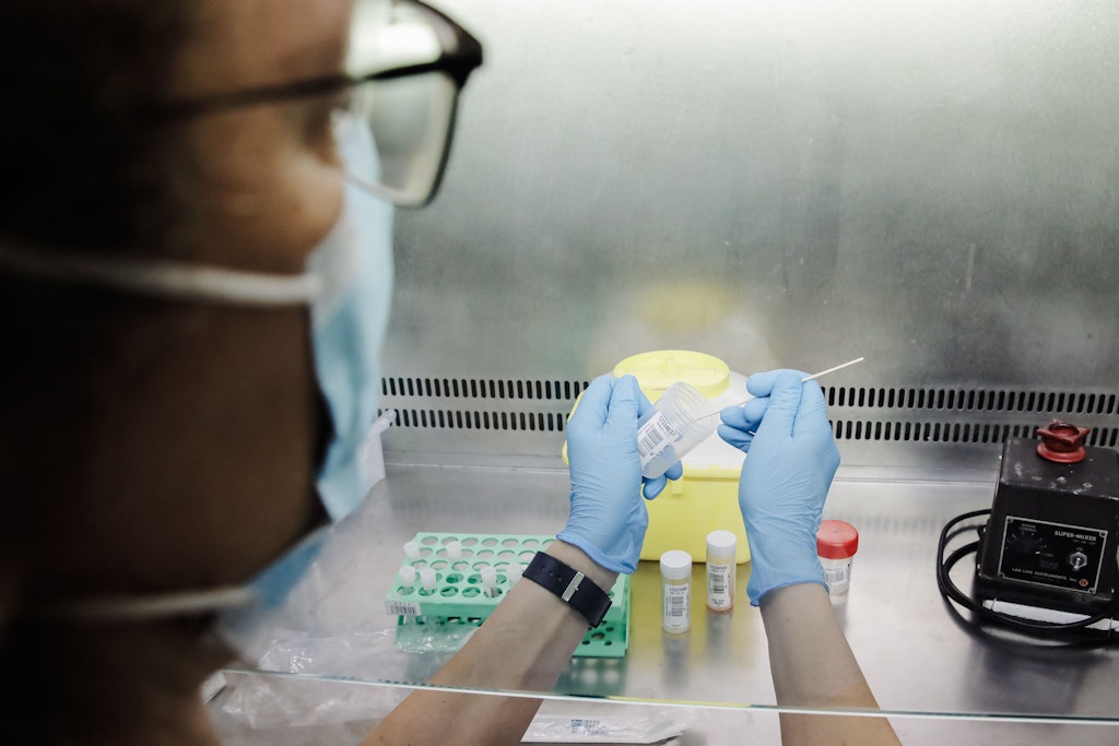 Eine Krankenschwester führt einen PCR-Test zur Erkennung des Affenpockenvirus durch.