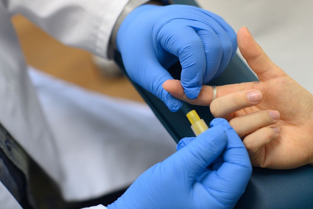 Ein HIV-Test wird durchgeführt. (Archivbild)