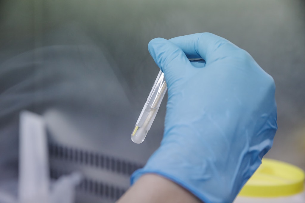 PCR-Test zur Erkennung des Affenpockenvirus (Symbolbild).