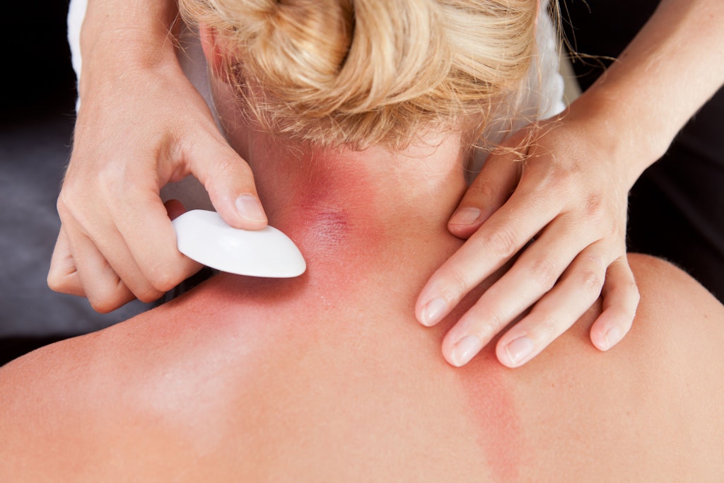 Die traditionell chinesische Methode taucht immer Häufiger in Spas oder bei Chiropraktikern auf