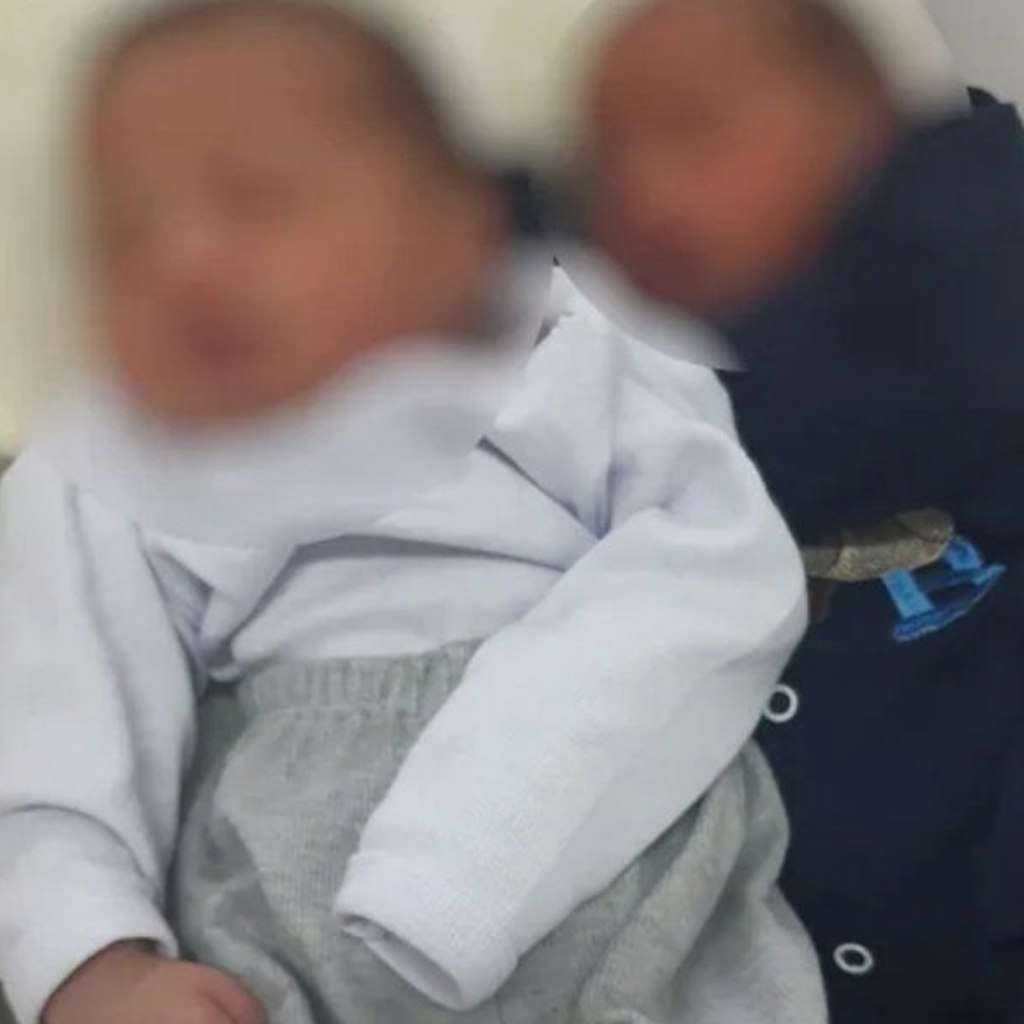 Diese zweieiigen Zwillinge haben verschiedene Väter. Ihre Mutter hatte am Tag der Zeugung Sex mit verschiedenen Männern.