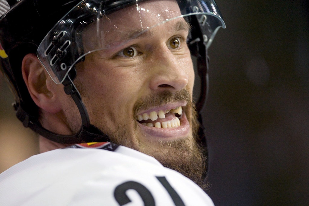 John Tripp, ehemaliger deutscher Eishockey-Nationalspieler, hat im Laufe seiner Profikarriere Zähne eingebüßt. Ähnliches blüht Menschen, die an Parodontose leiden.