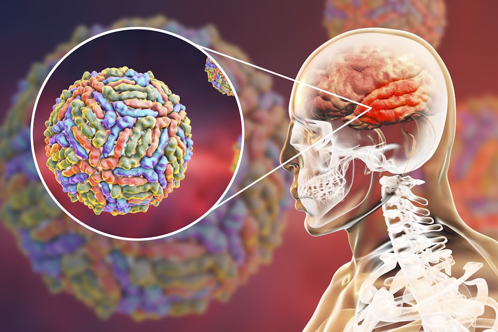 Das West-Nil-Virus: Bei einem Teil der Patienten tritt eine Entzündung im Hirn auf. In seltenen Fällen entwickelt sich eine Enzephalitis. Mögliche Symptome sind dann mentale Veränderungen, Muskelschwäche und schlaffe Lähmungen.