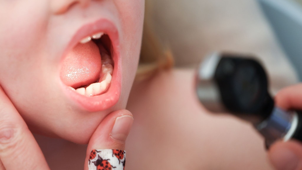 Wegen der angespannten Lage können Eltern ab sofort auch bestimmte Vorsorgeuntersuchungen für ihre Kinder vorübergehend verschieben. Die Kindermedizin ist derzeit am Limit