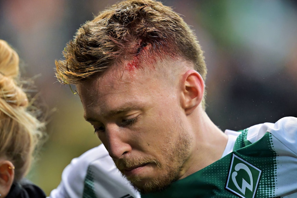 Ex-Hertha-Profi Mitchell Weiser (28) musste im Trikot von Werder Bremen gegen Borussia Dortmund richtig einstecken.