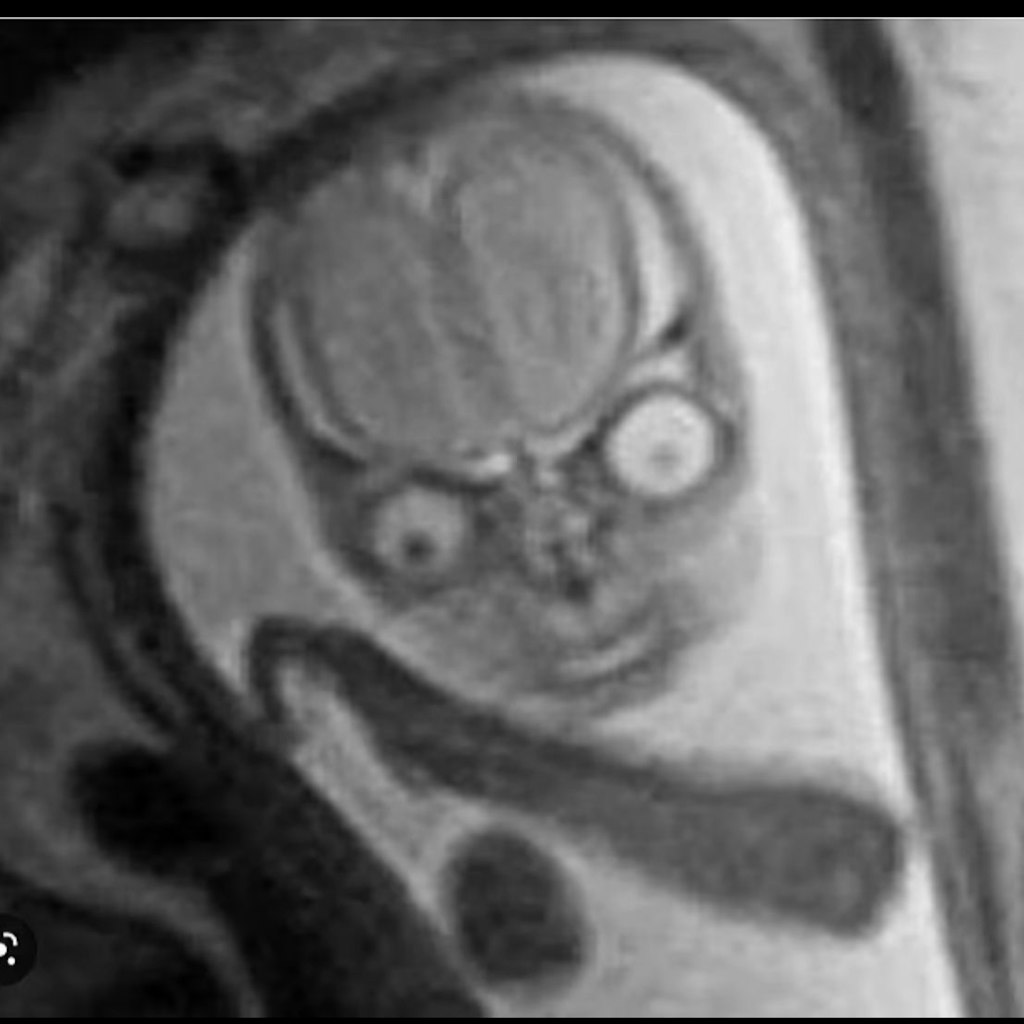 Ein weiteres Ultraschallbild des Grauens.